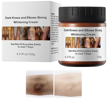 Forte crema sbiancante per ginocchia e gomiti scuri, la pelle scura su tutto il corpo, crema correttiva per ascelle, ginocchia, gomiti e interni delle cosce per tutti i tipi di pelle