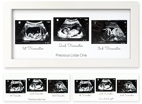 Trio Baby Bilderrahmen für Ultraschallbilder - Bilderrahmen Ultraschallbild Baby, Ultraschall Bilderrahmen Schwangerschaft, Ultraschallbilder Rahmen, Geschenke für Werdende Mamas (Alpine White)