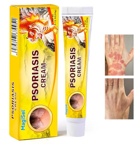 Anti Juckreiz Salbe, Beruhigende Hautcreme bei Juckreiz und Schuppenflechte