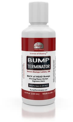 Bump Terminator Severe Bumps Lotion (120ml)
