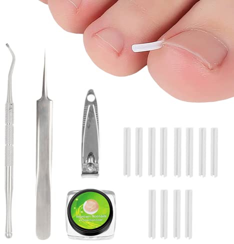 Ingrown Toenail Correction Treatment Kit with 12 Pcs Ingrown Toenail Correction Pad Recover Clips Ingrown Toenail Corrector Straightener Strips for Women Men's Nail Treatment Pedicure Tool (4 Pcs Set)