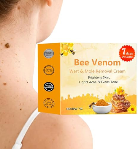 Crema Per La Rimozione Di Talpe Di Verruche Al Veleno D', 2 Pezzi, 30 G Di Crema Per La Rimozione Di Verruche Ed Etichette, Rimozione Di Verruche Ed Etichette Di Veleni Ad Azione Rapida, Crema