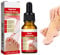 Ingrown Toenail & Cuticle Support Oil – Helps Maintain Nail Health, Softens Thick Nails & Eases Discomfort