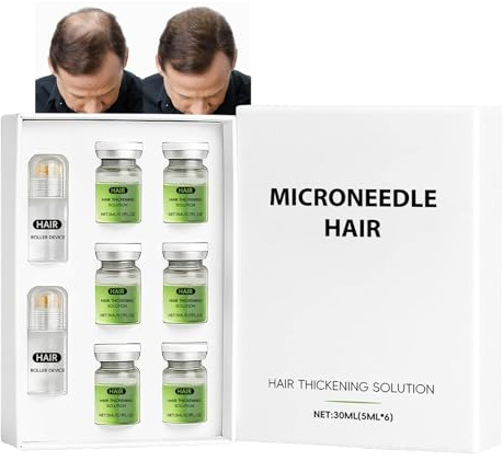 Alphainfuse Hair Regrowth System, Micro Infusion Hair Serum, Derma Roller
