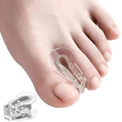 MEMNUN's weiche und hochelastische SEBS Zehentrenner, Hallux Valgus, Ballenzeh, Hammerzeh, überlappender Zehenkorrektor, Yoga Zehentrenner, 10 Stück