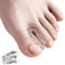 MEMNUN's weiche und hochelastische SEBS Zehentrenner, Hallux Valgus, Ballenzeh, Hammerzeh, überlappender Zehenkorrektor, Yoga Zehentrenner, 10 Stück
