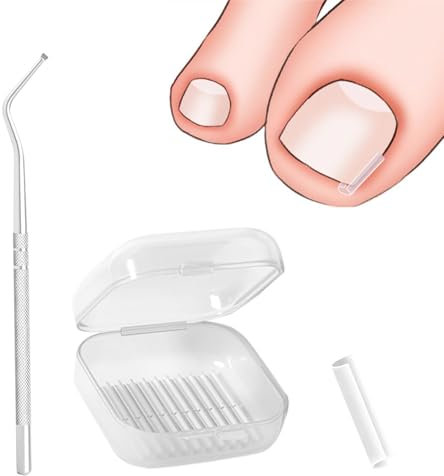 40 Stück Eingewachsene Zehennägel Set,Nagelkorrekturspange,Eingewachsene Zehennägel Kit,Einweg Nagelkorrekturspange,Für Korrekturen des Einwachsens von Zehennägeln,Die Fußpflege