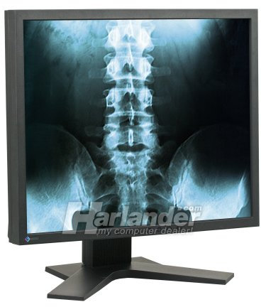 Eizo Radiforce MX191 LCD Monitor 19