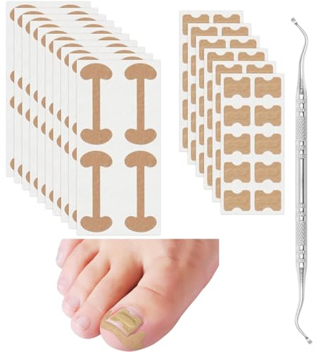2 Types Ingrown Toenail Treatment Patch with Ingrown Toenail Tool, Includes 100 PCS Ingrown Toenail Corrector Patch, Professional Ingrown Toenail Corrector Tools for Toenail Care Protect Toe Nail
