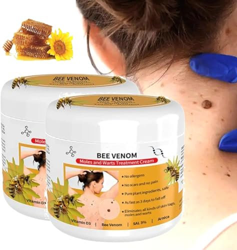 2pcs Bee venom moles and warts removal cream, Bienengiftcreme, Bienengift Creme, 30ml feuchtigkeitsspendende Creme für Frauen und Männer, Bee Venom Cream, für alle Hauttypen (30ml)