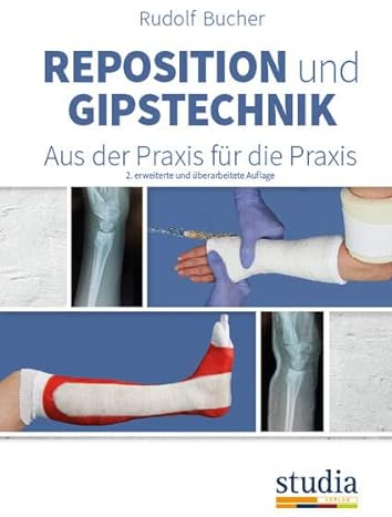 Reposition und Gipstechnik II: Aus der Praxis für die Praxis