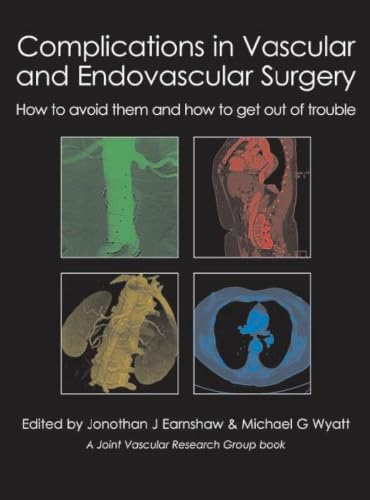 Complications in Vascular and Endovascular Surgery: How to Avoid Them and How to Get Out of Trouble