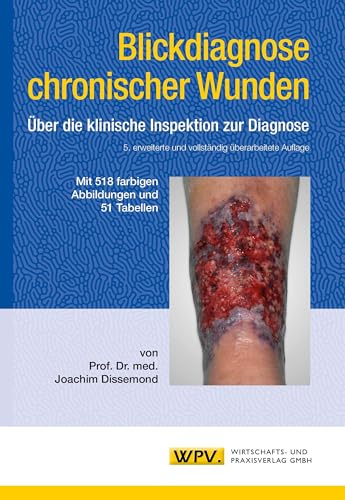 Blickdiagnose chronischer Wunden: Über die klinische Inspektion zur Diagnose