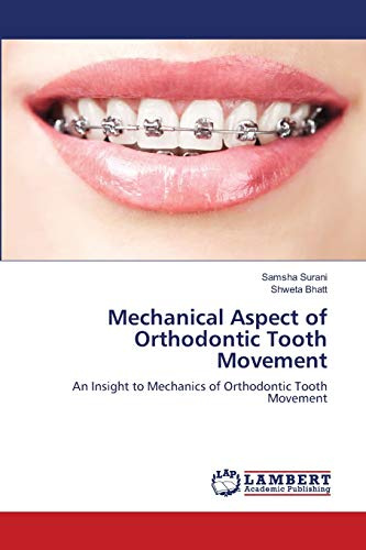 Mechanical Aspect of Orthodontic Tooth Movement: An Insight to Mechanics of Orthodontic Tooth Movement