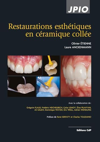 Restaurations esthétiques en céramique collée, 2e éd.