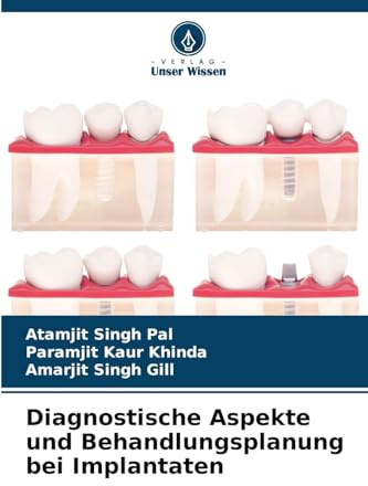Diagnostische Aspekte und Behandlungsplanung bei Implantaten: DE