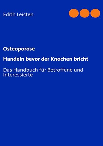 Osteoporose: Handeln bevor der Knochen bricht