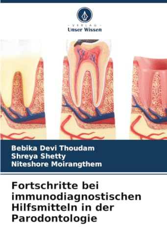 Fortschritte bei immunodiagnostischen Hilfsmitteln in der Parodontologie
