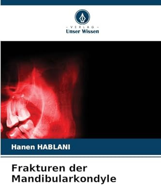 Frakturen der Mandibularkondyle