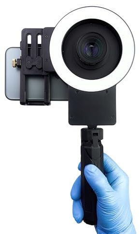 MK-23 Dental Photography Light for Cellphone - MK23 Ring Light - Intraoral Photos and Videos with a Phone for Dentist