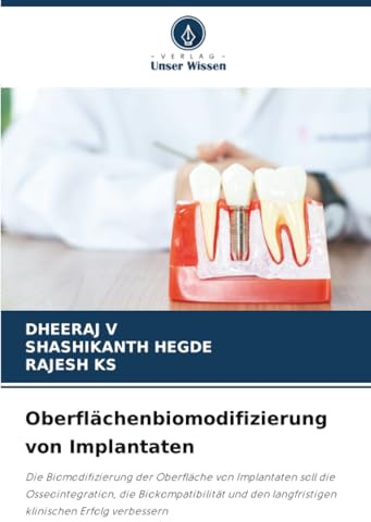 Oberflächenbiomodifizierung von Implantaten: Die Biomodifizierung der Oberfläche von Implantaten soll die Osseointegration, die Biokompatibilität und den langfristigen klinischen Erfolg verbessern