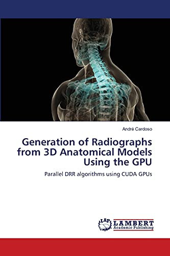 Generation of Radiographs from 3D Anatomical Models Using the GPU: Parallel DRR algorithms using CUDA GPUs