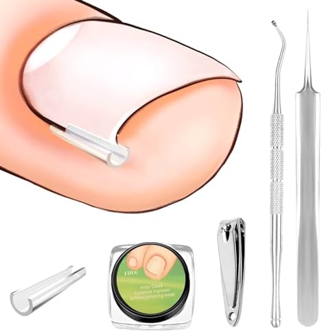 Xerteam 60 Stück Eingewachsene Zehennägel Set, Zehennagelkorrektur für Eingewachsene Zehennägel, Zehennagel Korrektur Patch, Korrektor Pediküre Werkzeugen Mit Nagelknipser, Nagelzange, Pinzette