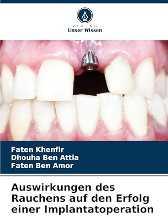 Auswirkungen des Rauchens auf den Erfolg einer Implantatoperation