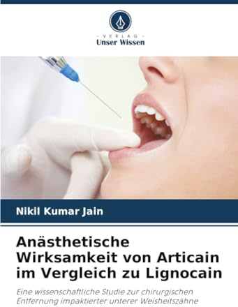 Anästhetische Wirksamkeit von Articain im Vergleich zu Lignocain: Eine wissenschaftliche Studie zur chirurgischen Entfernung impaktierter unterer Weisheitszähne