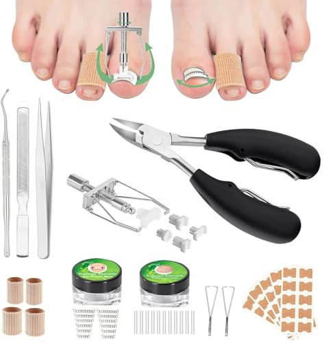 XdealCozyxc Ingrown Toenail Tool Kit with File and Lifter, Ingrown Toenail Corrector Strips and Patch for Toe Pain Relief