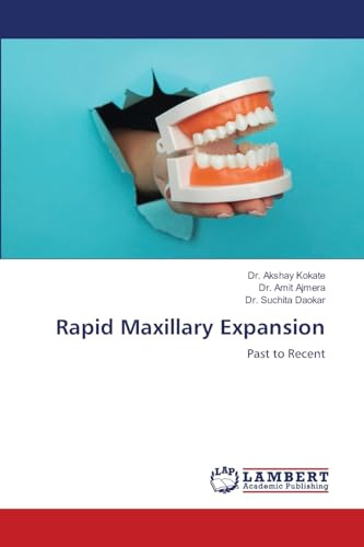 Rapid Maxillary Expansion: Past to Recent