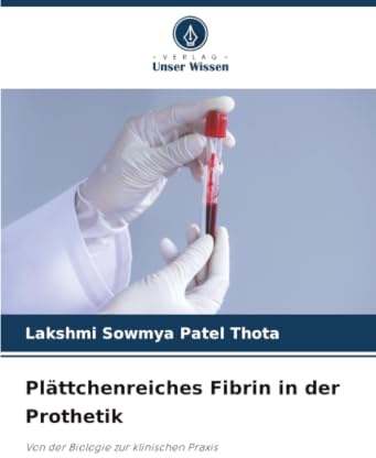 Plättchenreiches Fibrin in der Prothetik: Von der Biologie zur klinischen Praxis