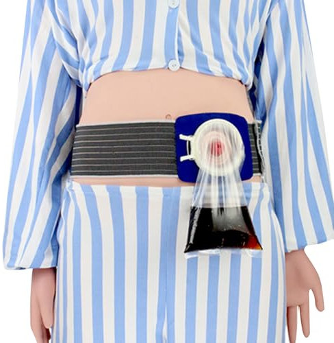 YZWZZXC Stoma Bandage, Nabelbruchbandage, Enthält 160 Stomabeutel und Eine Klemme, zur Verwendung Nach Kolostomien, Vorbeugung von Hernien