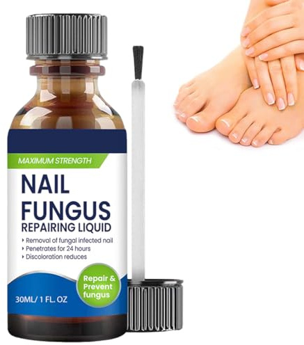 1 Piezas Hongos uñas pies,Tratamiento Uñas Pies, Reparadores de Uñas Solución, Cuidado Uñas Dañadas, Fortalece la Uña, La Uña se Regenera de Forma Natural, 30ml,B