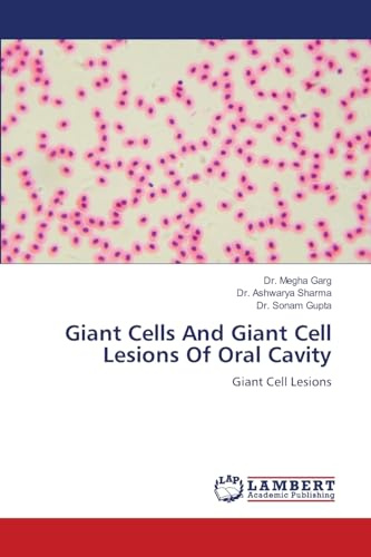 Giant Cells And Giant Cell Lesions Of Oral Cavity: Giant Cell Lesions