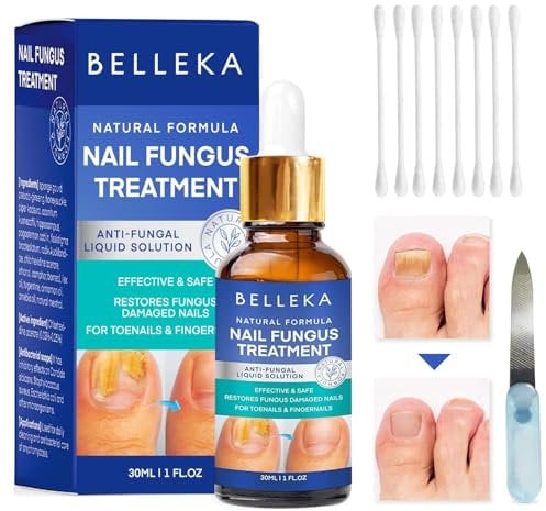 Toenail Fungus Treatment Extra Strength, Fungal Nail Treatment, Toe Nail And Finger Nail Repair For Damaged Discolored Thick Nails - With Nail Care Set Tools (30ML)
