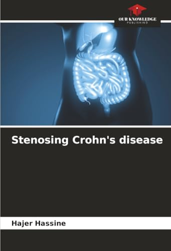 Stenosing Crohn's disease: DE