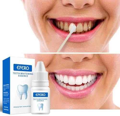 Kit di vernice sbiancante e polvere lucidante per denti - Essenza sbiancante per denti sicura per lo smalto, rimozione professionale delle macchie da caffè, tè, cola - Illumina il sorriso
