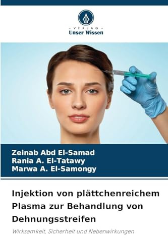 Injektion von plättchenreichem Plasma zur Behandlung von Dehnungsstreifen: Wirksamkeit, Sicherheit und Nebenwirkungen
