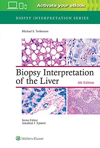 Biopsy Interpretation of the Liver (Biopsy Interpretation Series)