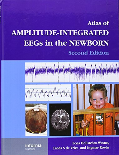 An Atlas of Amplitude-Integrated EEGs in the Newborn (Encyclopedia of Visual Medicine Series)