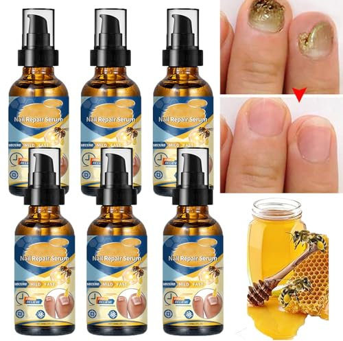 Bee Venom Nail Repair Serum, Nail Bee Treatment Serum, Bee Venom Nail Care Serum, Nail Defense Bee Venom Treatment Serum, Nail Strengthener for Damaged Nails (6pcs)