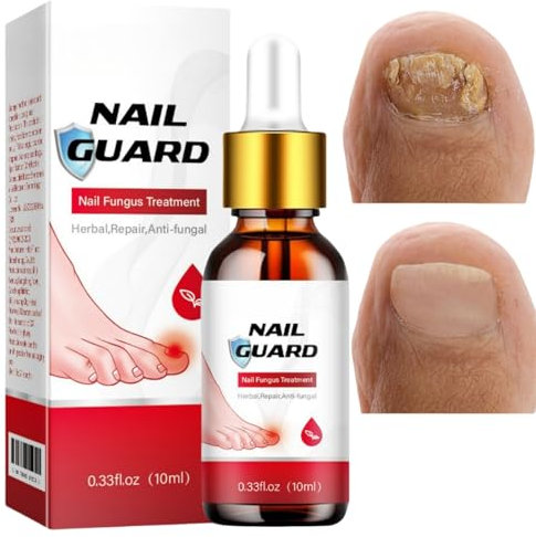 Fungal Nail Treatment for Toenail,Toe Nail Fungal Treatment,Anti Fungus Nail Repair and Strengthen,Toenail Fungus Treatment,Fungal Nail Drop,Fix and Renew Damaged,Cure Nail Fungus,Restoring Nails