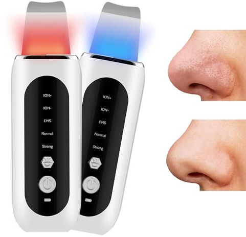 iksvmsis Dispositivo Peeling Viso, Pulizia Viso Ultrasuoni Professionale, Spatola Ad Ultrasuoni per Pulizia Viso, Skin Scrubber Professionale Rimozione Punti Neri di Comedone Pulisce I Pori