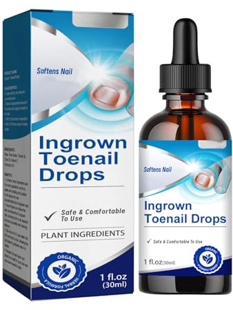 Ingrown Toenail Liquid - 30ML Ingrown Toenail Correction Drops - Nail Helper Ingrowth Toenail Oil - Trimming Toenail Softening Drops