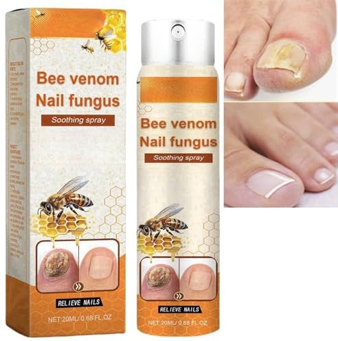 Bee Venom Nail Soothing Spray,Fungal Nail Treatment,Bee Venom Nail Treatment Serum,Toenail Fungus Treatment,Anti-Fungal Nail for Toes,Nail Growth Repair Serum Spray, Nail Strengthener for Damaged Nail