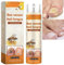 Bee Venom Nail Soothing Spray,Fungal Nail Treatment,Bee Venom Nail Treatment Serum,Toenail Fungus Treatment,Anti-Fungal Nail for Toes,Nail Growth Repair Serum Spray, Nail Strengthener for Damaged Nail