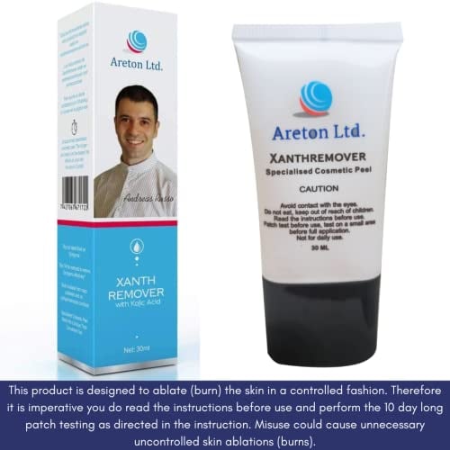 Areton kosmetisches Peeling Xanthremover, 70% Glykolsäure-Gel für professionelles kosmetisches Peeling, seborrhoische Keratose, Xanthelasma, Altersflecken, Entfernung von Dehnungsstreifen