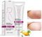 Crema cicatrice smagliature, rimozione cicatrici da gravidanza, trattamento smagliature, riparazione maternità, rimozione smagliature dalla gravidanza,40g