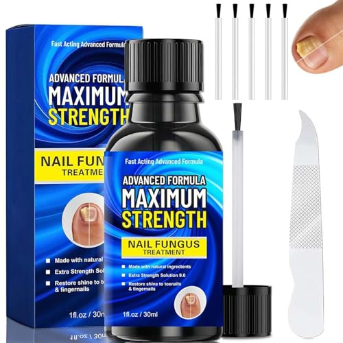 Fungal Nail Treatment Extra Strong, Toenail Fungus Treatment & Nail Repair Solution, Restore and Strengthen Damaged, Broken Nails, Powerful Antifungal Formula for Healthy Nails, 30ml